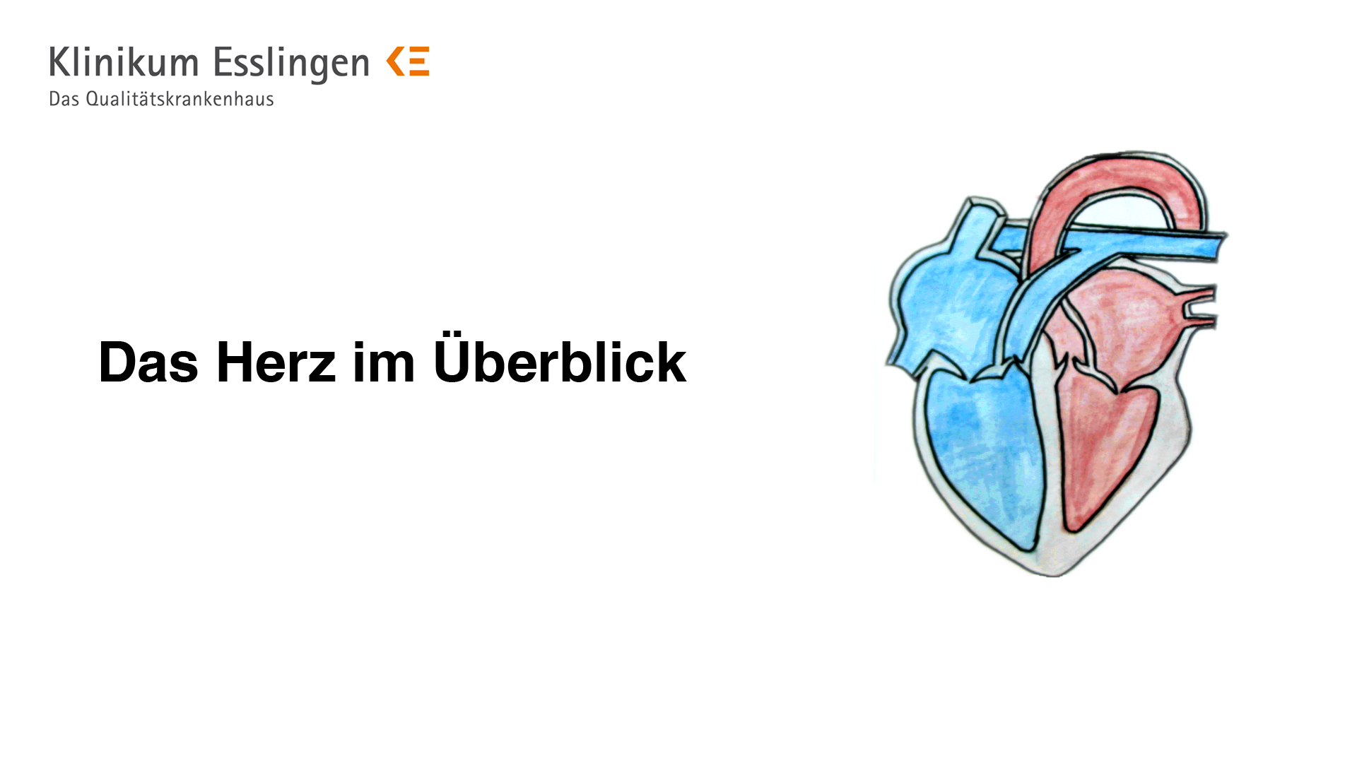 Wie Funktioniert Unsere Pumpe Klinikum Esslingen