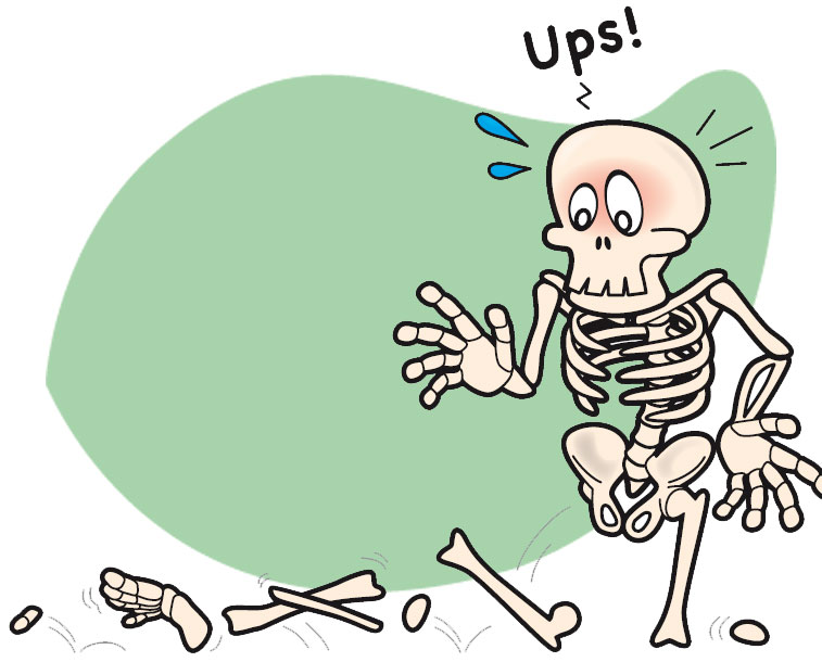 Comiczeichnung: Skelett verliert Knochen